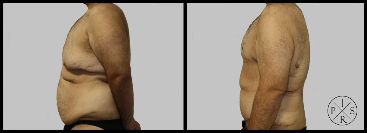 View 5
