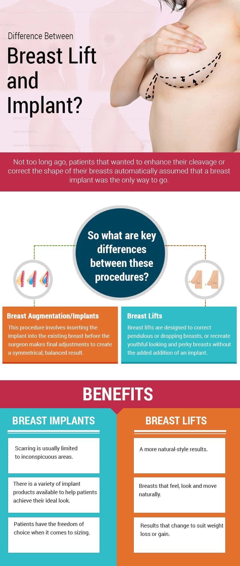 Difference Between Breast Lift and Implant? Not too long ago, patients that wanted to enhance their cleavage or correct the shape of their breasts automatically assumed that a breast implant was the only way to go. So what are the key differences between these procedures? Breast Augmentation/Implant: this procedure involves inserting the implant into the existing breast before the surgeon makes final adjustments to create a symmetrical, balanced result. Breast Lift are designed to correct pendulous or dropping breasts, or recreate youthful looking and perky breasts without the added addition of an implant. Benefits of Breast implants scaring is usually limited to areas, there is a variety of implant products available to help patients acheive their ideal look. Patients have the freedom of choice when it comes to sizing. Benefits of breast lift are more natually style results, breasts feel, look and move more natural, results that change to a suit weight loss or gain.