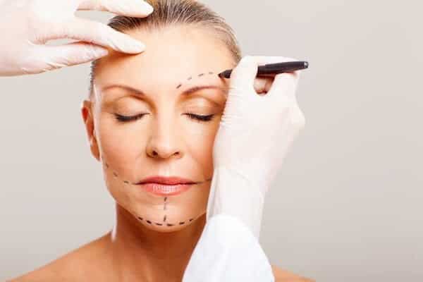 woman preparing for facial fat transfer