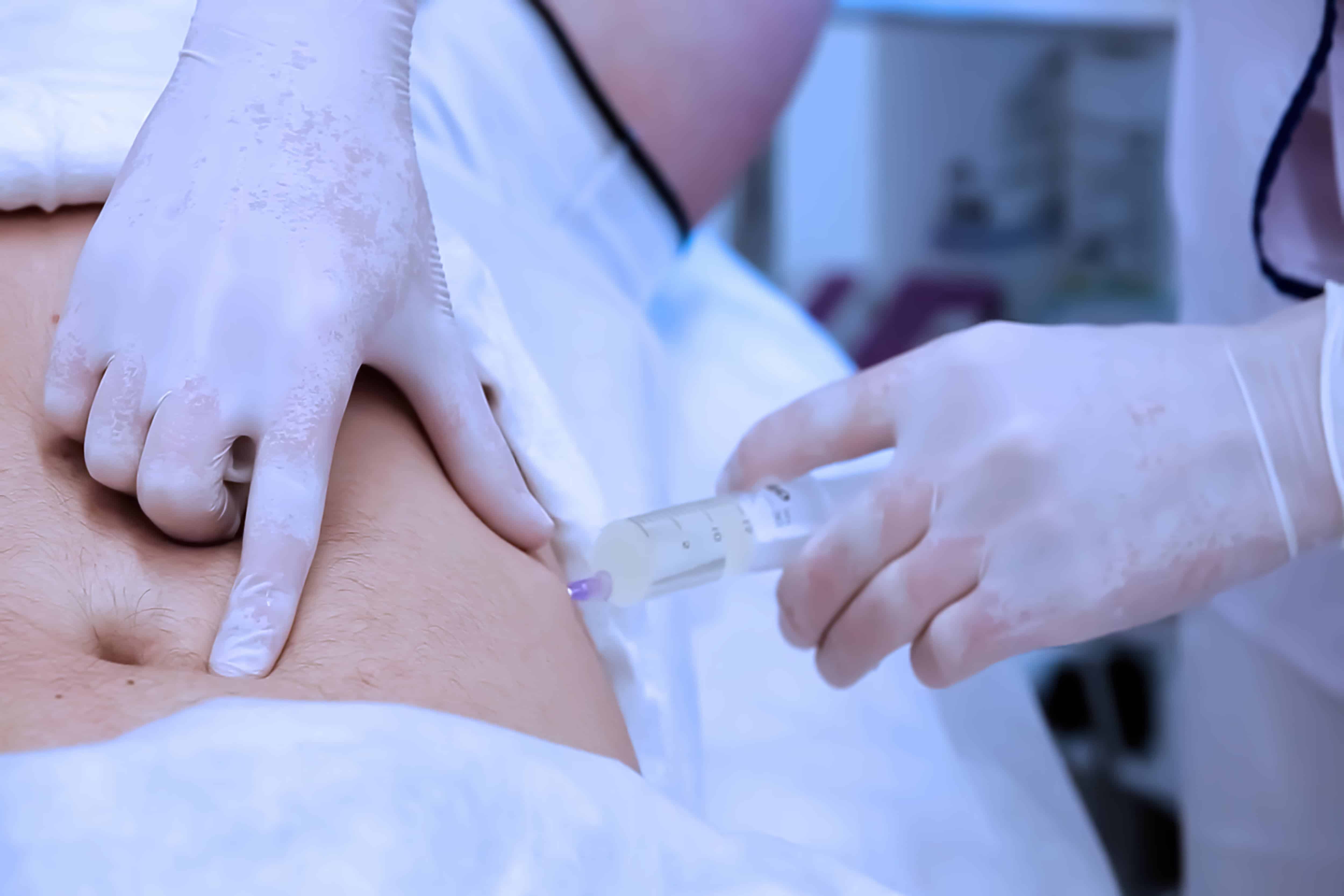 Sydney patient receiving fat transfer