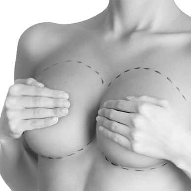 Inverted nipple surgery Sydney