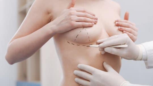 Woman getting prepared for breast surgery