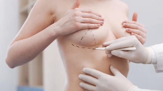 Sydney plastic surgeon mapping out breast surgery on patient